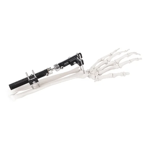 Wrist Joints External Fixator