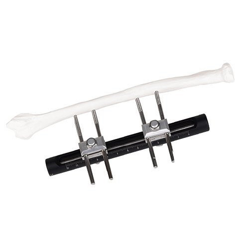 Wrist Joints External Fixator