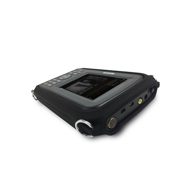 Medical Device Diagnostic Portable Digital Ultrasound Scanner SONO R