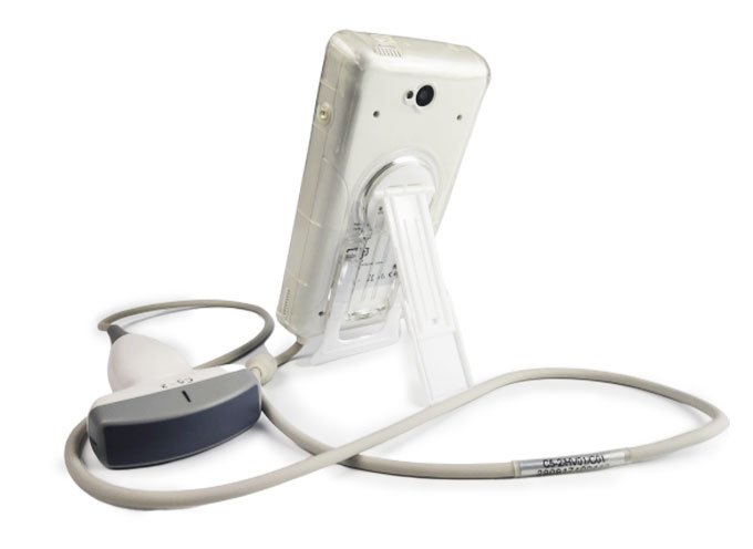 CScan® Android Ultrasound Scanner