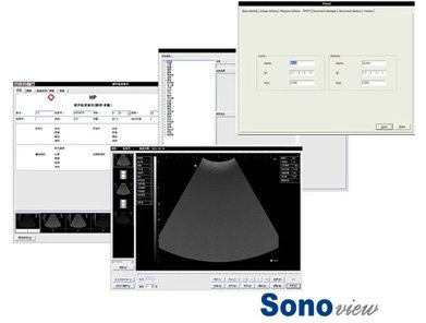 Sonoview® Full Digital Imaging Ultrasound Scanner