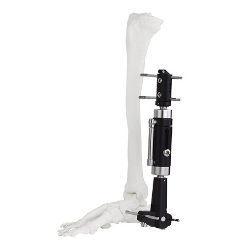 Ankle Joint Fragment External Fixator