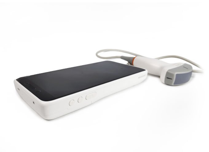 CScan® Android Ultrasound Scanner