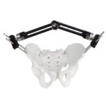 Pelvic Fragment External Fixator - Type B