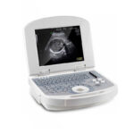 Dolphi® Pro Portable B/W Ultrasound Scanner
