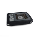 Medical Device Diagnostic Portable Digital Ultrasound Scanner SONO R - Image 5