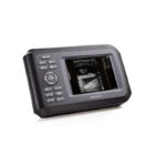 Medical Device Diagnostic Portable Digital Ultrasound Scanner SONO R